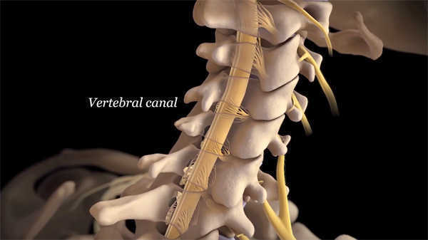  骨科醫(yī)學(xué)科普3d動(dòng)畫(huà)演示